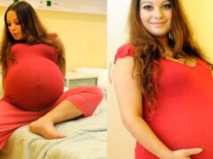 23-ročná žena si myslela, že čaká dvojčatá. Lekár bol šokovaný, keď na ďalšom ultrazvuku vyšla pravda najavo!