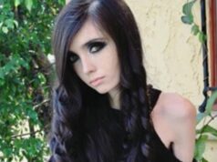 Najslávnejšia anorektička sveta desí Instagram: Zhodila ďalšie kilá a ostali na nej iba kosti! FOTO