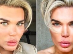 Živý Ken Rodrigo Alves priznal problémy: Štyri roky som necítil chuť jedla!