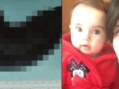 Dievčatko (8) bolelo brucho a mala ho nafúknuté: TOTO jej z neho lekári vyoperovali! FOTO