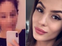 Úplne iná Týnuš! Popálená youtuberka po 8 mesiacoch ukázala CELÚ TVÁR. FOTO