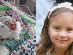 POMOC! Natálke (6) v tábore vážne popálili polku tela!