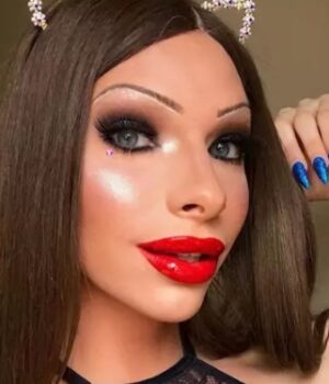 Žena minula tisíce eur na plastiky. Zverejnila fotky pred premenou: Mohla sa takto zohaviť?