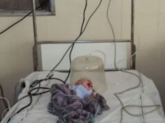 Keď uvidela tvár svojho syna chcela ho otráviť. To, čo urobil doktor, zasiahne každého!