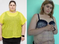 Silvia schudla, ale stále má depky z postavy: Takto vyzerá po plastike!