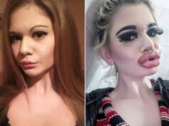 Andrea sa pýši najväčšími perami na svete! Zväčšila sa už aj inde. Foto po poslednom zákroku desí!